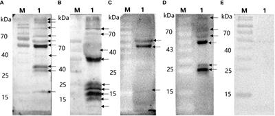 Mucosal and cellular immune responses elicited by nasal and intramuscular inoculation with ASFV candidate immunogens